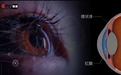 心灵窗口养护者——康洁伦