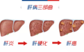 肝病三部曲丨复星诊断一体化肝病实验室检测解决方案助力肝病早诊早治