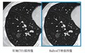 国产人工智能医学影像重建增强技术逐步引领全球