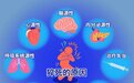猝死前，身体的 3 个求救信号别忽视