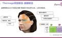 关于升级版热玛吉Thermage面眼联合应用文献解读