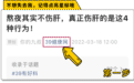 “下面”的毛有什么用？能刮吗？发白了意味着啥？男女都需了解