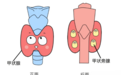 为什么甲状腺切除术后手脚发麻？米诺娃朱精强教授告诉你原因