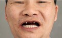 中家医家庭医生口腔全智能即刻用种植牙当天种当天用