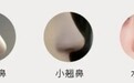 拥有这款鼻子，美到下一个level~辽宁杏林整形隆鼻