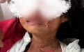 教育局称女童被泼开水系“恶作剧”，未免说得过于轻率了
