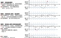 市场人士：私募新规落地或提升雪球门槛至1000万