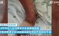 14岁女生被机构教官体罚致昏迷？媒体：严惩之外家长也需反思