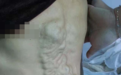 门诊必看的 50+ 典型图！这些病灶你能一眼就诊断吗？