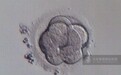 家恩德运：影响胚胎移植成功的因素有哪些？你想知道的都在这