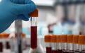 新血液检查技术或可帮助人类提前数年测到癌细胞DNA