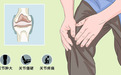 运动后关节不适？科学指南：护关节需从应对胶原流失开始