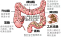 黄山便秘调理体验中心帮助70岁陈阿姨的健康蜕变