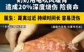 奶奶用电吹风给5岁孙子吹背致其20%皮肤烧伤！冬季警惕这些“低温烫伤”
