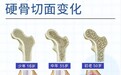 革新科技，重塑健康，安提唯坦SGF骨源因子破解骨骼肌肉健康难题