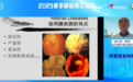 北京爱尔英智眼科医院成功举办2025年春季眼底病交流会