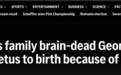 吵翻了！已确认脑死亡，医院却让她持续妊娠 3 月，直至分娩…