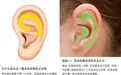 耳朵一圈为啥总有黄色油垢，刮一下能有满满一指甲？