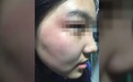 17岁女生与男同学冲突中被打致颅脑损伤，校方回应