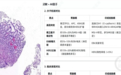 重庆发布“诊疗级”病理AI大模型 可识别9大器官57种肿瘤亚型