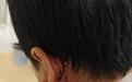 9岁男孩去同学家串门被拴住的狗咬伤引赔偿纠纷，狗主应担责吗？律师释法