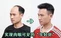 应对“发量不足”武汉人有新招，定制假发人气火爆