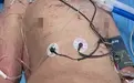 掀开被子一看，主任都沉默了，这种病人都敢收