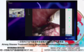 从中国到全球：华芯医疗一次性支气管镜，破解呼吸介入诊疗痛点