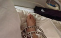 河南一患者“断骨增高致瘸”追踪：涉事医院及科室遭罚，医生被吊销执业证书