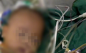5月大女婴手术后离世，父亲：根据尸检报告，孩子没有这个病哪来的手术指征
