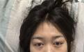 “公厕被打女孩”3年后确诊白血病：我想活下来，希望大家帮帮我
