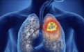 人参皂苷Rh2：多种肿瘤研究为何持续关注它？