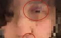 17岁女生控诉大一男生对其多次殴打、性侵，逼迫自己签下“免责书”，处理结果披露