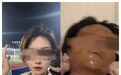 男子追求女主播不成多次报复：扎车胎、泼强酸、放置爆炸物