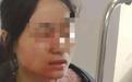 女教师劝架被学生用镊子戳伤眼，谁来给受伤的老师撑腰？