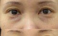 温州职场人踩坑：再贵遮瑕，也盖不住真性眼袋