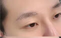 纹眉变红变蓝怎么修复？专业机构选择避坑指南