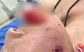 中国游客在泰国脸部中弹，女儿：母亲住院只能吃流食，将起诉索赔