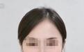 女网红蕾蕾突然去世，年仅32岁