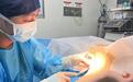 破解腋臭术后护理难题：医用胶原蛋白液促恢复防感染