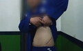 缅北电诈回流人员：那时候不要说一个肾了，锯条腿我都愿意，只要能走 由