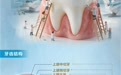 图说百科丨全国爱牙日·健康口腔 健康生活