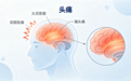 秋季偏头痛高发？基药品种都梁软胶囊—专治头痛，预防复发