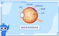 滇西眼底诊疗实力见证：大理爱尔眼科尹志成主任成功救治 6 期重度糖网丽江患者