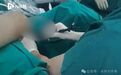 男子网购硅胶，自行注射“丁丁”增粗！结果溃烂、流脓、发臭