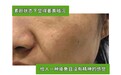 Scep青春胶囊内服烟酰胺实测，温和补充营养，舒缓面部岁月暗沉纹路
