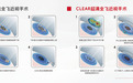 听说你准备做CLEAR超清全飞近视激光手术？这份术前到术后完整指南请收好