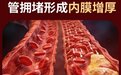 2026高压人群心脑累，十大水蛭素品牌怎么选？口碑好的水蛭素护管更安心