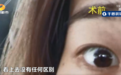 女子双眼皮手术后“变”单眼皮 退费诉求遭拒