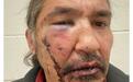 加拿大原住民酋长遭警察拳打脚踢，惊动了总理特鲁多！